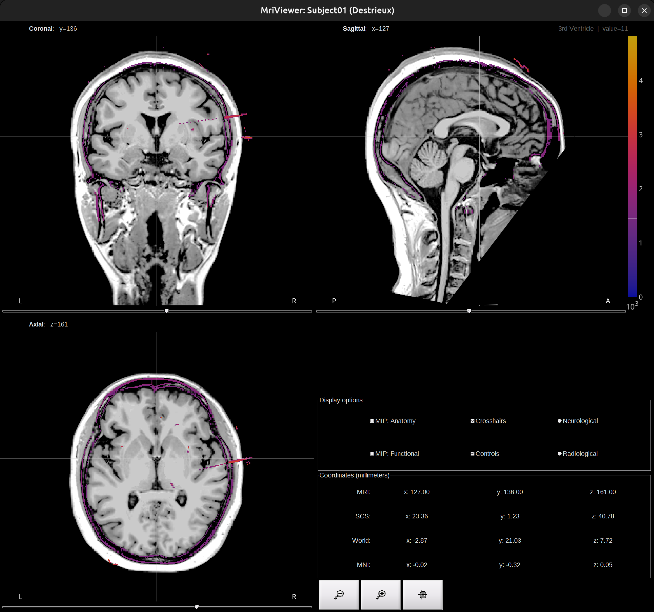 coreged_ct_mri