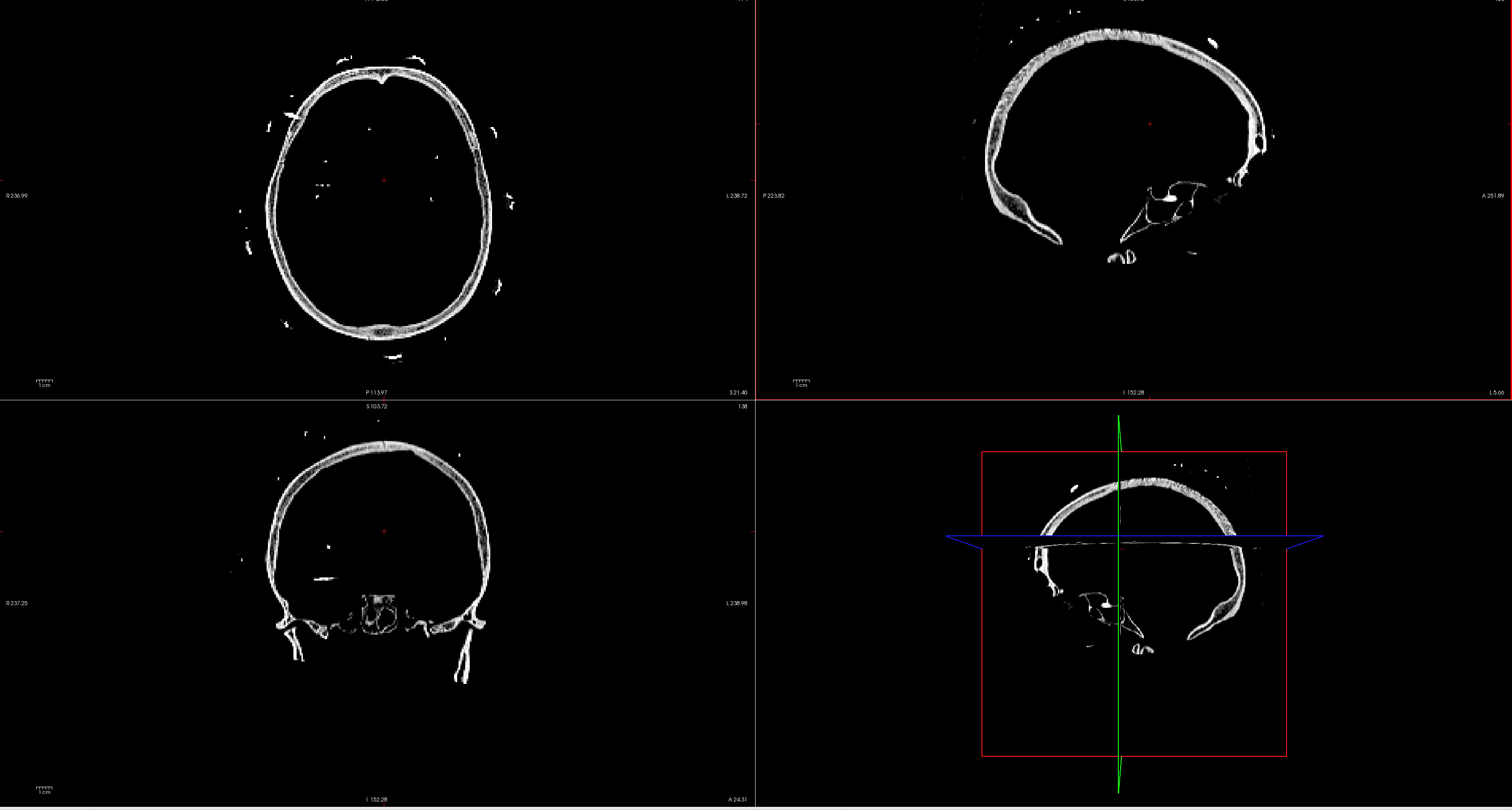 ct_image