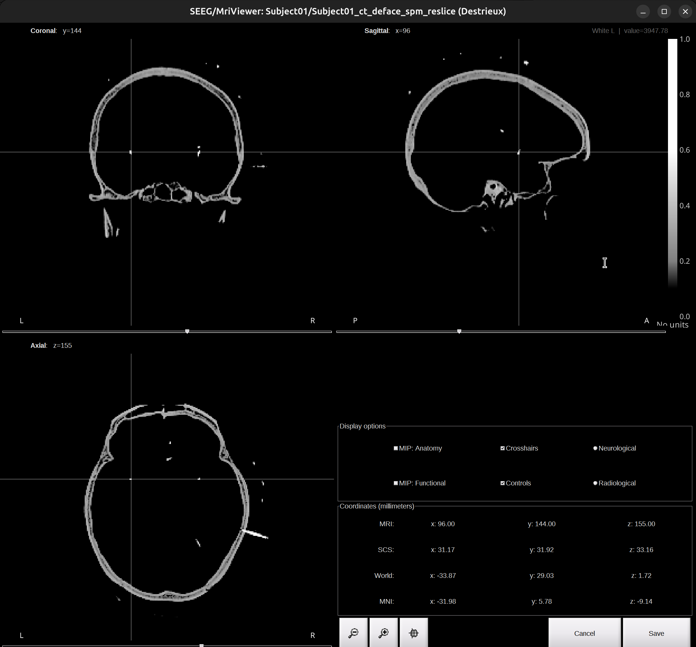 localization_step_4