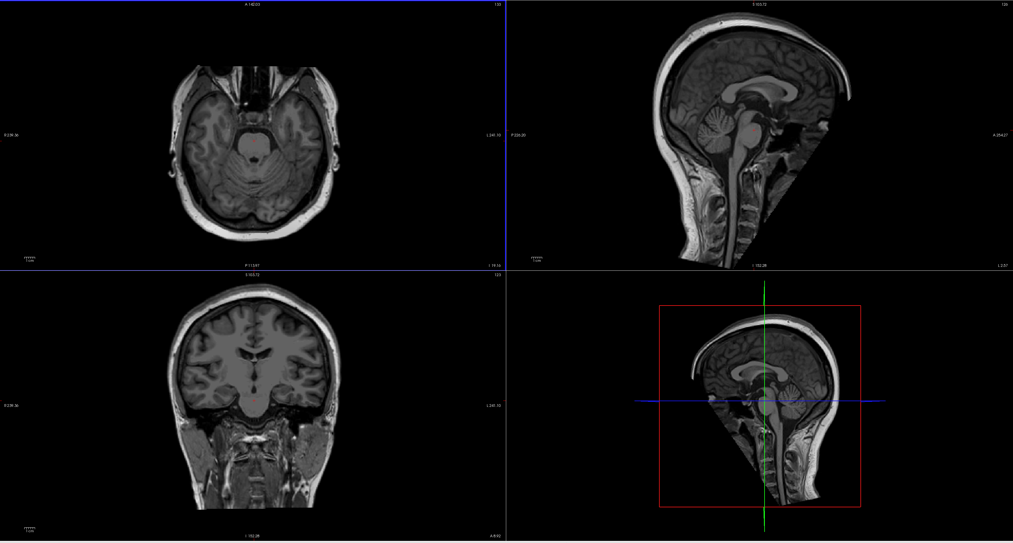 t1_image