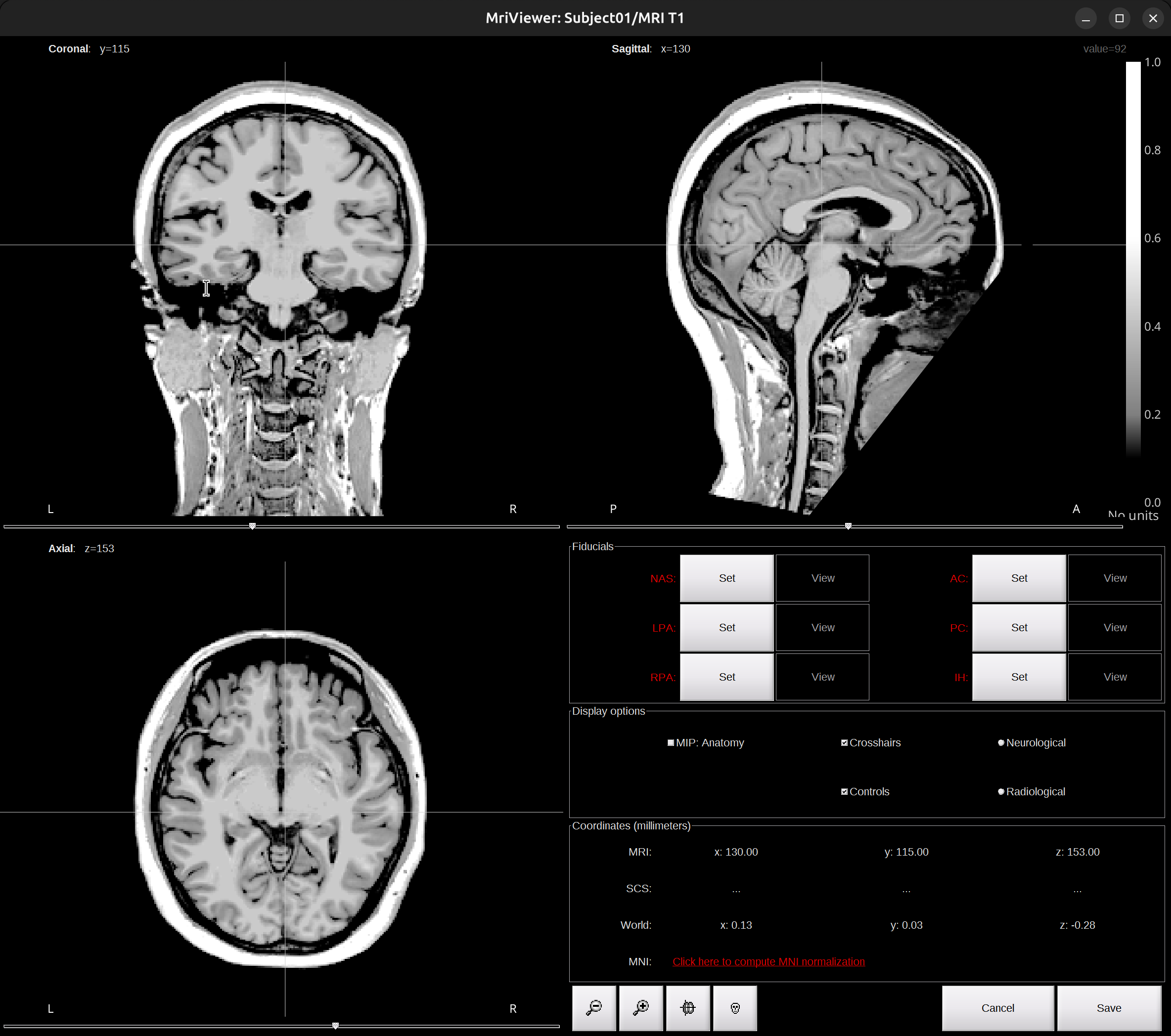 mri_viewer