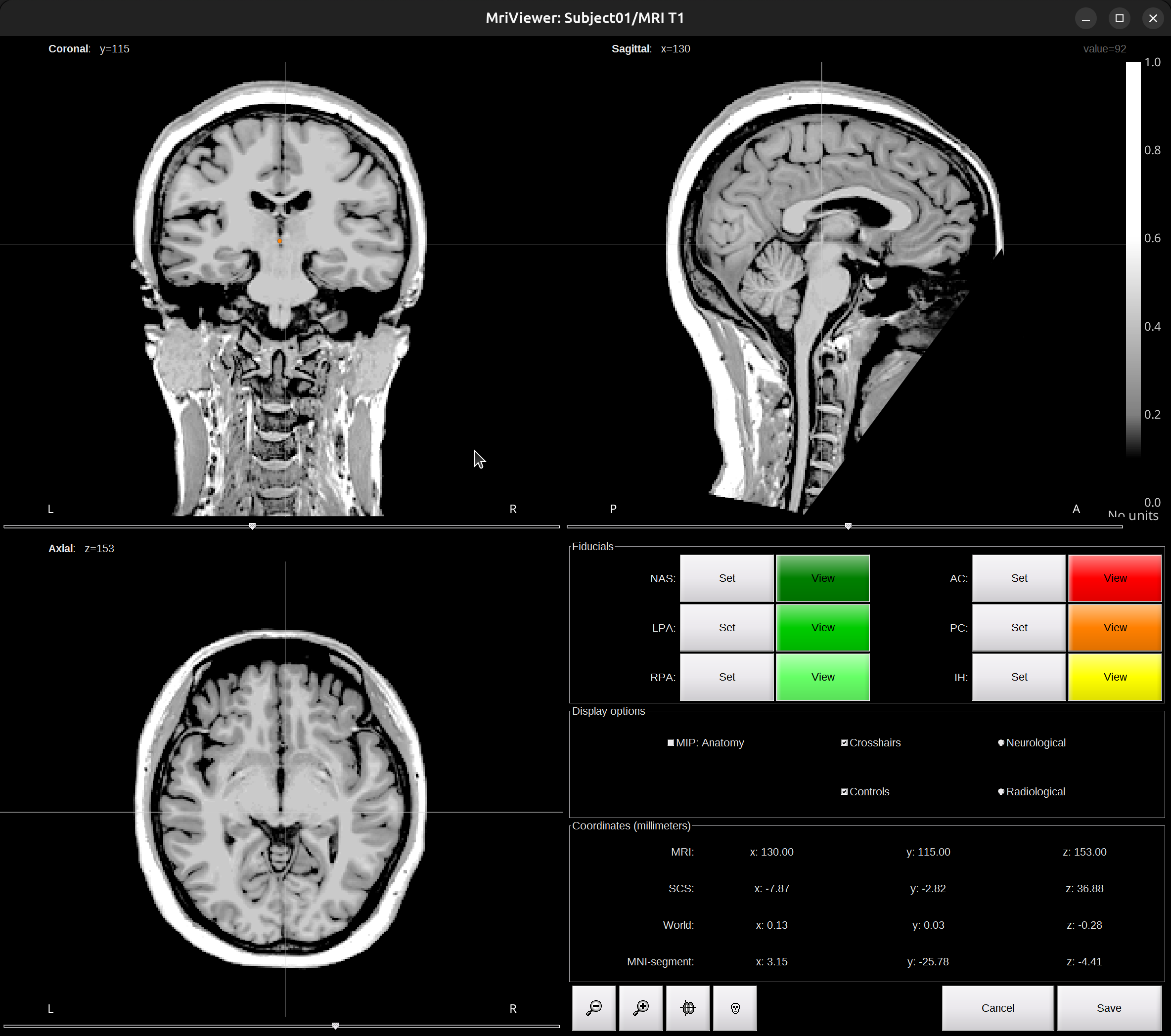 mri_viewer2